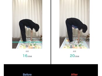 鹿児島整体院/腰痛/反り腰/鹿児島/整体