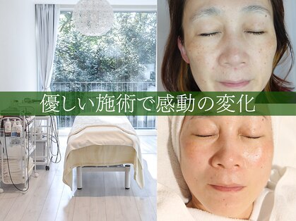 モチポカ 本駒込(mochipoca)の写真