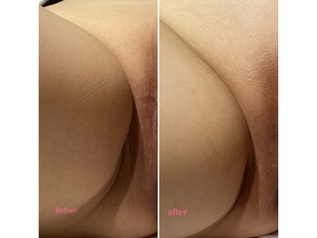 セレーネボーテプラス/