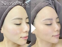 ビースト 下北沢店(B-st.)/フェイシャル｜全顔1回