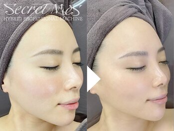 ビースト 下北沢店(B-st.)/フェイシャル｜全顔1回