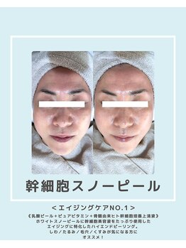 ソワナ(soina)/【神楽坂駅/フェイシャル/毛穴】