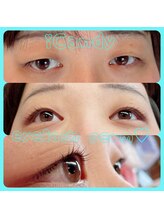 アイキャンディ(iCandy)/まつ毛パーマ