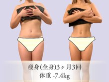 ベルペール(Belle perle)/【痩身】インドエステ