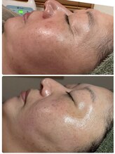 アロマセラピーサロン クオーレ(Cuore)/肌の基礎からしっかりお手入れ