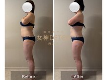 女神デトックス 西宮店(女神DETOX)