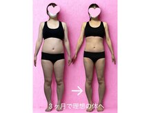 【痩身ダイエット・耳つぼ・毛穴洗浄】Total beauty Salon de SKey