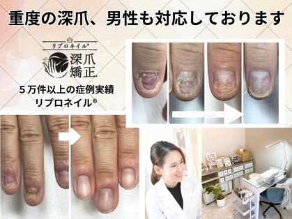 深爪矯正専門ネイルサロン アニューの写真