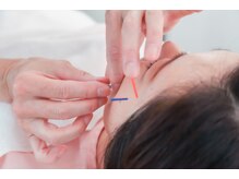 美容鍼灸salonまつもと/