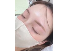 ティンクアイ(Tink eye)