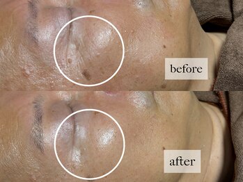 ヒナノ 矢場町店(HINANO)/フォーエバーヤング