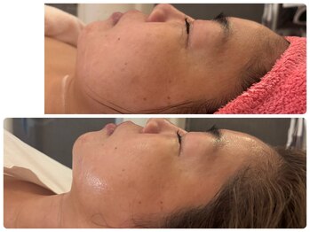 サロンドデュイ/1回施術/50代 EMSリフトアップ