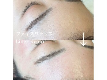 リベルキョウト 京都駅前店(Liber Kyoto)/フェイスワックス脱毛
