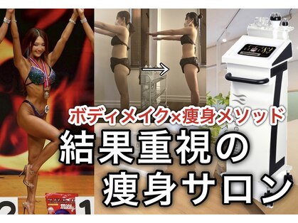 アイボディ(iBDY)の写真