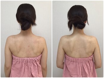 ザセイム(the same)/コルギで美背中！