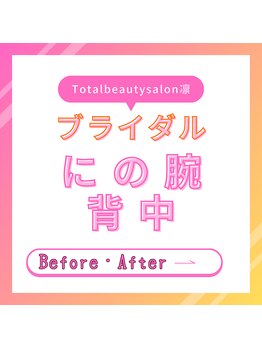 トータルビューティーサロン 凛/ブライダルのビフォーアフター