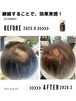 サンシー整体(SunCY整体)/７０代女性