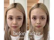 ザ ハイライト 恵比寿の雰囲気（顔のむくみ、歪み、左右差、リフトアップもお任せください☆）