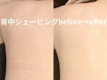 ももとゆでたまご/背中シェービング人気