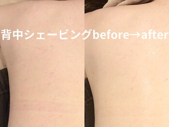 ももとゆでたまご/背中シェービング人気