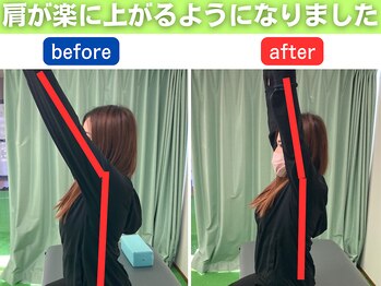整体×パーソナルトレーニングREHASUL【リハスル】肩こり 大平台店【12/17 OPEN予定】/肩が楽に上がるようになりました