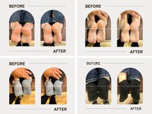 一度でも変化は見られますが改善には継続施術が必要です！