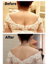 トータルエステティック レイ(Lay)/ブライダルエステで背中も別人級