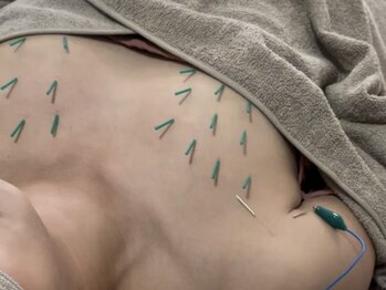 ユアン(YUAN)の写真/【お顔とセットで徹底アプローチ◎】バストケア◎22000円→11000円にてご用意あり♪理想を叶える!