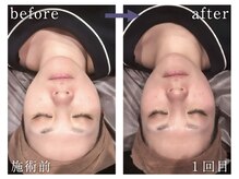 チル 渋谷店(CHILL)の雰囲気（【カラダ整う】お悩みを根本改善し、顔もお尻も小さく立体的に！）