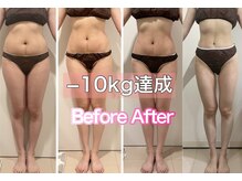 ヴィクシア(VIXIA)の雰囲気(リバウンドなしなのにすぐに結果がわかる本格痩身)
