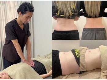 福多整骨院 整体院 円山/40代前半女性　腸もみ整体３回目