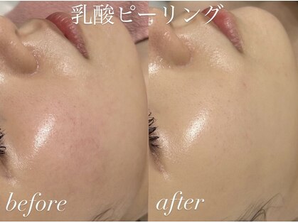 シーラックス(Sealax)の写真