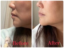 デザインファム(DESIGN FAM)/タイトニング４層打ち