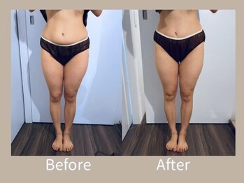 ビオラ(Viola)/◇ Before→After ◇