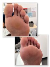 フットファースト 小田原大井町店/ビフォーアフター