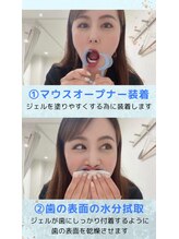 ホワイトニングショップ 新小岩店/施術手順【ホワイトニング】