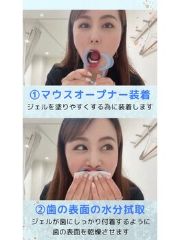 ホワイトニングショップ 新小岩店/施術手順【ホワイトニング】