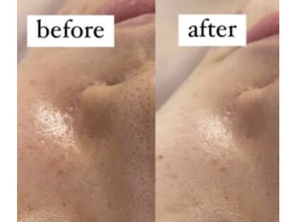 レクレアの写真