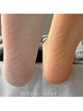 フットミー(foot mii)/