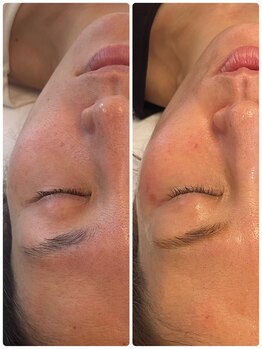 アールヨンマルハチ フェイスアンドアイ(R408.face&eye)/艶肌で巻き戻し肌