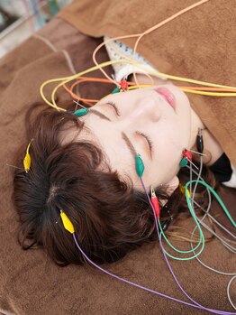 鍼灸院 はりエイト/■美容鍼