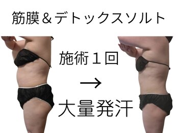 フロレゾン(Floraison)/劇的ビフォーアフター