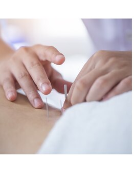 TJMととの鍼灸院/【鍼灸】ホスピタリティを大切に