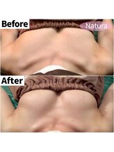 ナトゥーラ 心斎橋なんば本店(Natura)/痩せててもバストアップ可能★