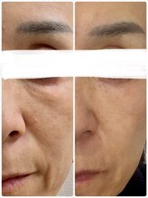 ジュエルビューティー(Jewel Beauty)/Dr.リセラ　本気の肌改善　ADS