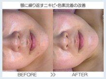 フェアリー(fairy)/