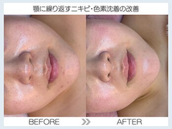 フェアリー(fairy)/