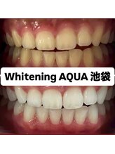 アクア 池袋店(AQUA)/ホワイトニング/池袋/東京/美白