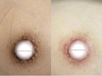 ジェニック(_genic)/ローマピンク