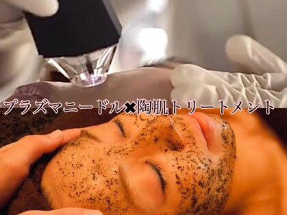 セリンダ(selinda)の写真